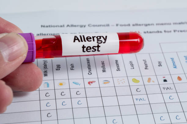 Food Allergy Testing (IgE)